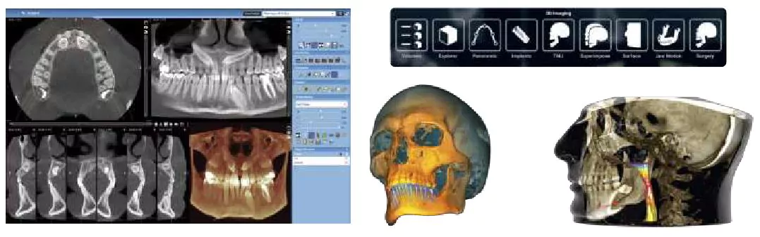 3D модуль Planmeca Romexis