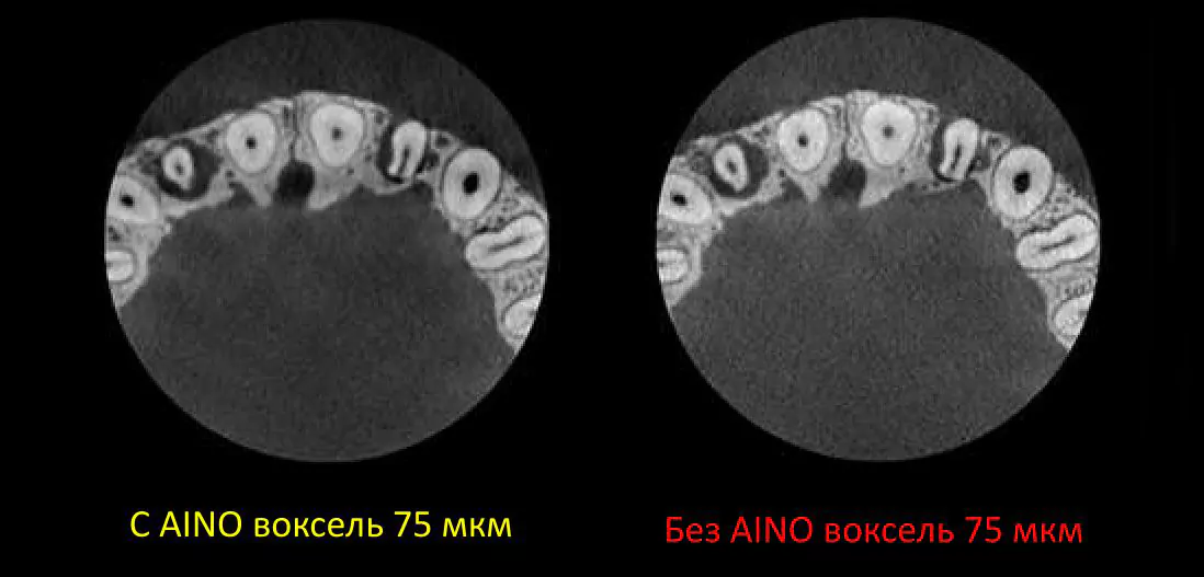 Planmeca AINO